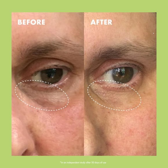 Kopari - NIACINAMIDE & CAFFEINE EYE BRIGHT CREAM - Picture 3 of 10